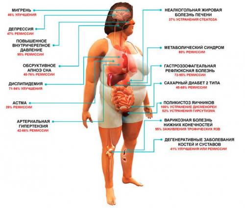 Как восстановить хрящевую ткань суставов. Какие препараты для восстановления хрящевой ткани рекомендуют врачи? 01