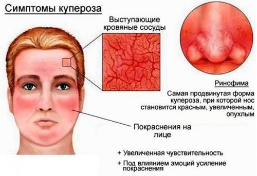 Как правильно готовить маску для лица с медом и яйцом. Маска для лица с медом и яйцом от морщин в домашних условиях