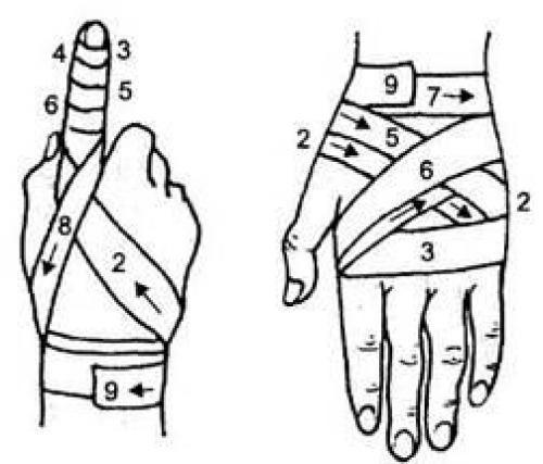 Техника наложения черепашьей сходящейся повязки на локтевой сустав 08 Техника наложения черепашьей сходящейся повязки на локтевой сустав 08