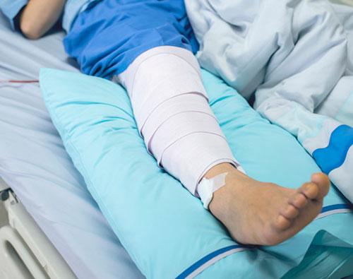 Тутор это, что. О фиксаторах колена в деталях 15