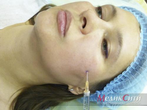 Почему кожа лица нуждается в увлажнении? 11 Почему кожа лица нуждается в увлажнении? 11