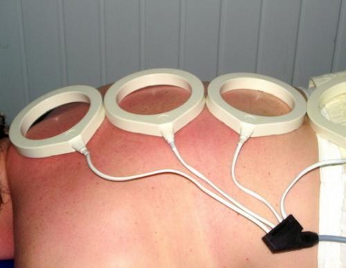 Физиотерапия при артрозе коленного сустава. Виды физиотерапии 14