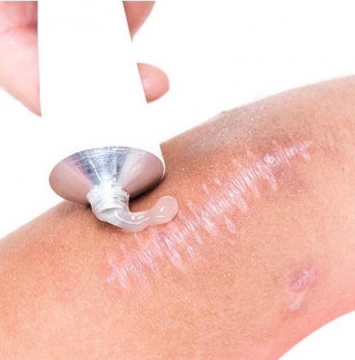 Способы использования сходящихся и расходящихся повязок для лечения травм 01 Способы использования сходящихся и расходящихся повязок для лечения травм 01