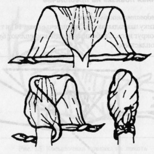 Какие виды заболеваний могут быть облегчены с помощью сходящихся и расходящихся повязок. Косыночные повязки