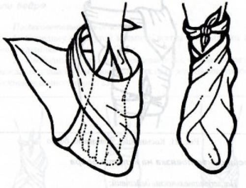 Какие виды заболеваний могут быть облегчены с помощью сходящихся и расходящихся повязок. Косыночные повязки