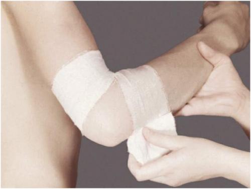 Как отличить сходящуюся черепашью повязку от расходящейся. Сходящаяся и расходящаяся черепашья повязка на локоть и колено