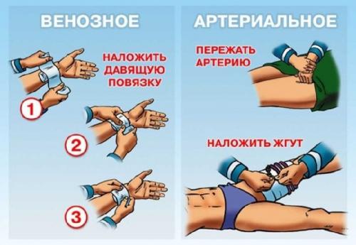 Как понять, что черепашья повязка расходится. Техника наложения