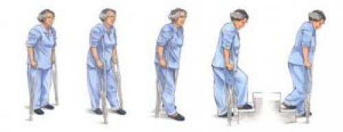 Упражнения после эндопротезирования тазобедренного сустава. Немного об операции 01