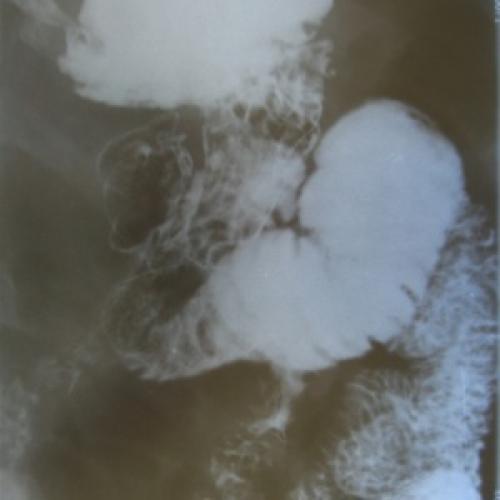 Общие принципы наложения эластичных бинтов. Как правильно накладывать эластичный бинт? 05 Общие принципы наложения эластичных бинтов. Как правильно накладывать эластичный бинт? 05