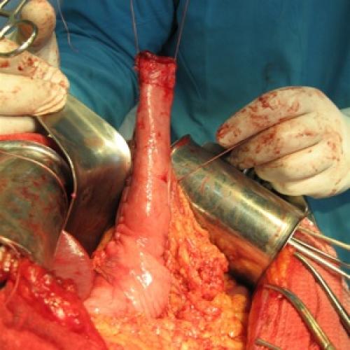 Общие принципы наложения эластичных бинтов. Как правильно накладывать эластичный бинт? 06 Общие принципы наложения эластичных бинтов. Как правильно накладывать эластичный бинт? 06