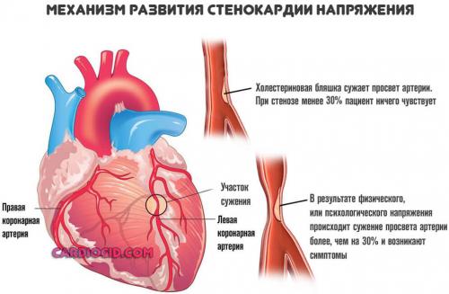 Таблетки от сердечной недостаточности без рецепта. Таблетки от боли в сердце: список названий и виды препаратов, принцип действия и совместимость