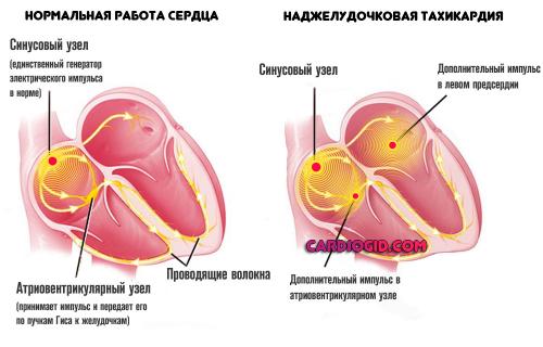 Таблетки от сердечной недостаточности без рецепта. Таблетки от боли в сердце: список названий и виды препаратов, принцип действия и совместимость