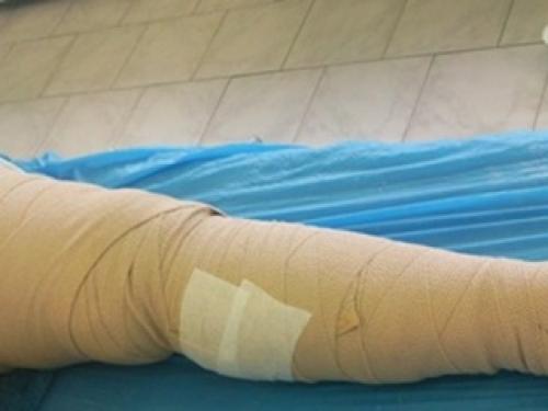 Бинт эластичный на плечевой сустав. Эластичные бинты. Дань уходящему времени или повседневная необходимость? 01