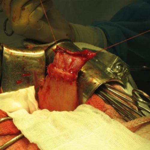 Бинт эластичный на плечевой сустав. Эластичные бинты. Дань уходящему времени или повседневная необходимость? 03