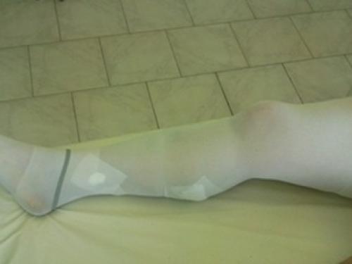 Бинт эластичный на плечевой сустав. Эластичные бинты. Дань уходящему времени или повседневная необходимость? 02