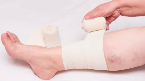 Повязки на нижнюю конечность: как выбрать и применить правильно 01