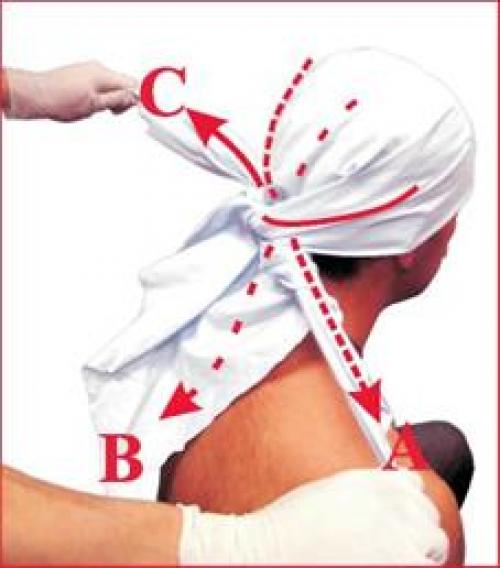 Косыночная повязка на плечевой сустав, как сделать. Техника наложения повязок Косыночные повязки