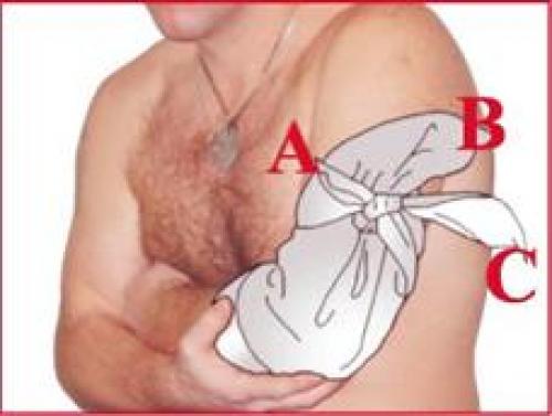 Косыночная повязка на плечевой сустав, как сделать. Техника наложения повязок Косыночные повязки