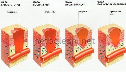 Как правильно обработать рану. Лечение ран и ссадин 01