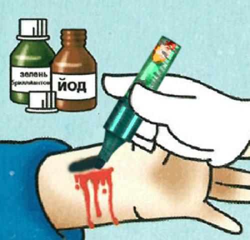 Как правильно обработать рану. Лечение ран и ссадин 11