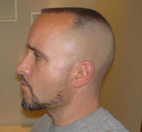 Мужские стрижки для круглого лица с залысинами. Виды стрижек для мужчин с залысинами