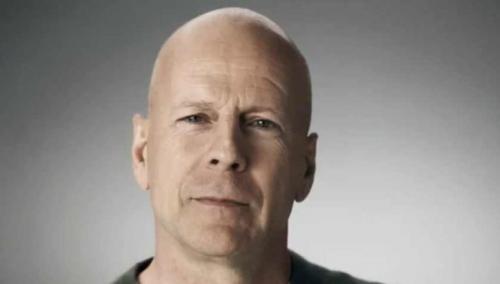 Мужские стрижки для круглого лица с залысинами. Виды стрижек для мужчин с залысинами