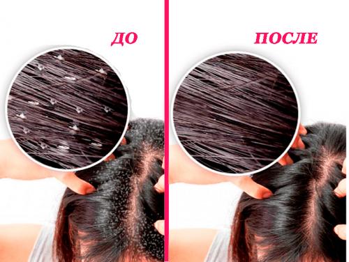 Маски для волос с солью. Правила и советы по нанесению 06