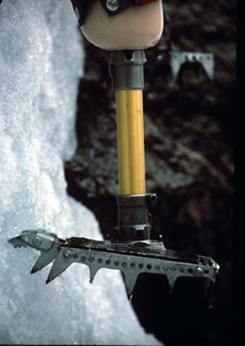 История протезирования от древности до наших дней. Эволюция протезов