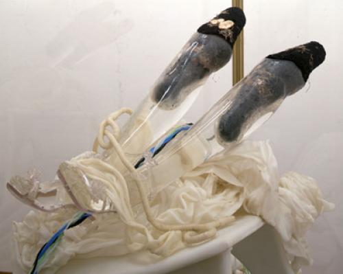 История протезирования от древности до наших дней. Эволюция протезов