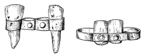 Как развивались технологии протезирования со временем