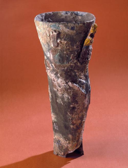 История протезирования от древности до наших дней. Эволюция протезов