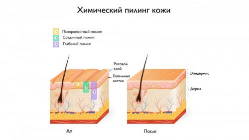 Как убрать возрастные пигментные пятна. Старческие пятна на лице: лечение 03 Как убрать возрастные пигментные пятна. Старческие пятна на лице: лечение 03