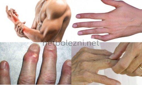 Хруст в пальцах рук. Хруст в суставах: хватит переживать. 02