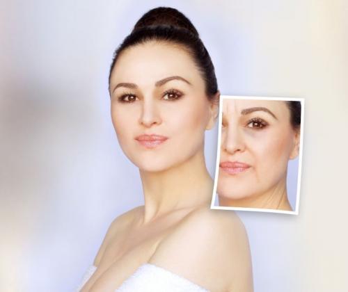 Омоложение лица после 50 лет без операции. Подтяжки и другие омолаживающие процедуры в возрасте 40-50 лет 03