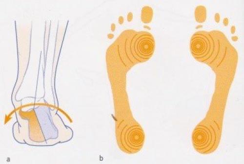 10 упражнений для укрепления стопы. 5 простых упражнений при плоскостопии 02