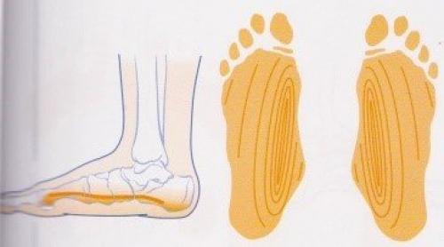 10 упражнений для укрепления стопы. 5 простых упражнений при плоскостопии 03