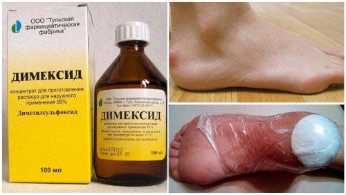 Димексид и новокаин Компресс пропорции.  Компресс с димексидом и новокаином  – 01