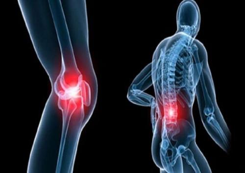 Болят ли суставы при аллергии. Аллергический артрит