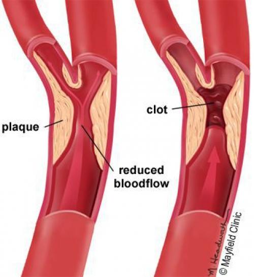 Как страдает кожа при сахарном диабете. Определение болезни. Причины заболевания 01