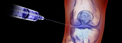 После укола гиалуроновой кислоты нельзя. 06