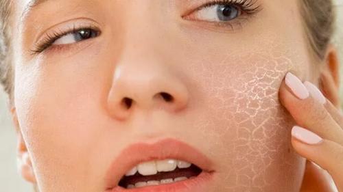 Что такое очень сухой обезвоженная кожа лица. Как помочь обезвоженной коже