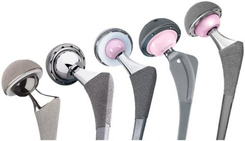 История развития эндопротезирования суставов. Как появилось эндопротезирование