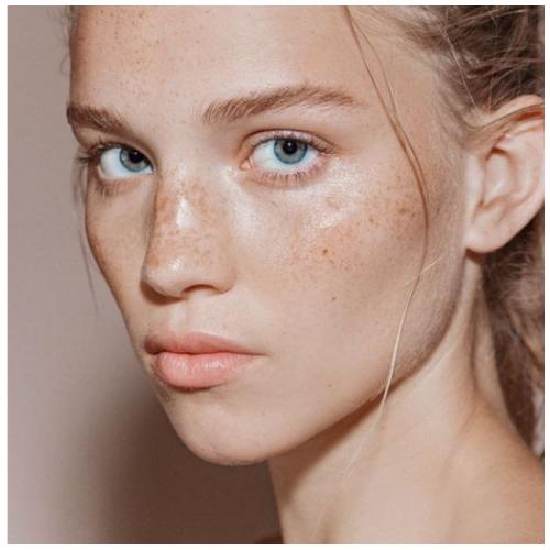 Как ухаживать за кожей с комедонами. От чего появляются комедоны: основные причины 01