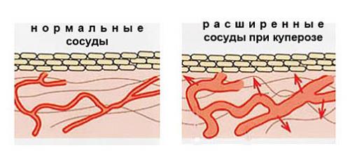 Какие эффекты можно ожидать после применения масок для сухой увядающей кож. Домашние омолаживающие маски 60+