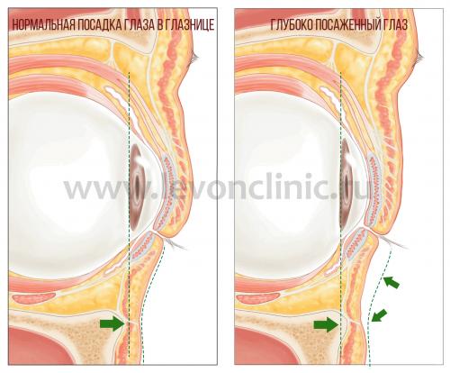 Лучшее средство от темных кругов под глазами. Давайте взглянем на анатомическое строение области глаз.