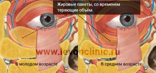 Убрать темные круги синяки мешки под глазами. Домашние тактики борьбы со стойкими синяками под глазами 11 Убрать темные круги синяки мешки под глазами. Домашние тактики борьбы со стойкими синяками под глазами 11