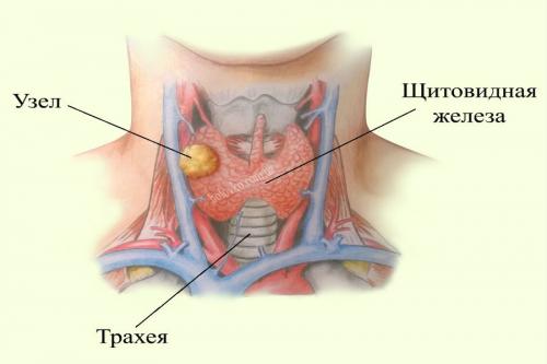 Щитовидная железа увеличена симптомы. Ольга Гвоздева, эндокринолог. Редактор А. Герасимова