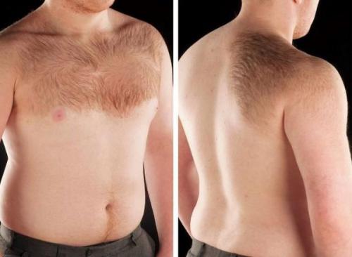 Как убрать пигментные пятна. Пигментация лица: как убрать 05