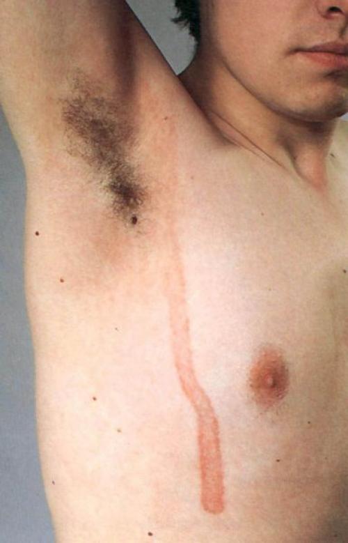 Как убрать пигментные пятна. Пигментация лица: как убрать 07