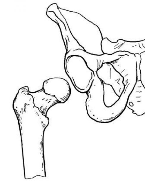 Рисунок тазобедренного сустава человека